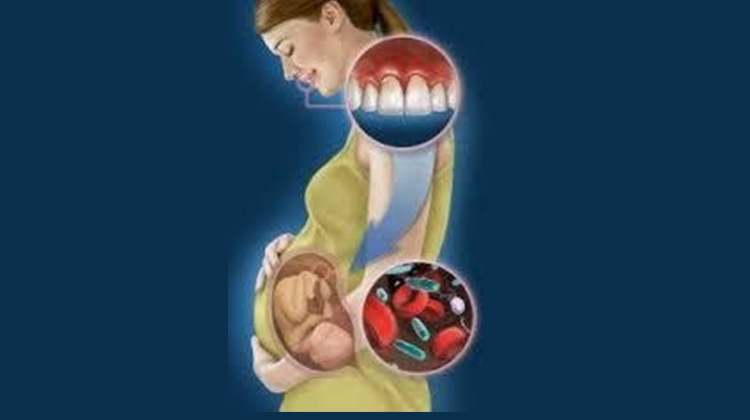 Are you suffering from Pregnancy gingivitis? What’s the treatment for it?